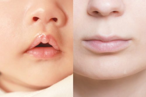 【累計100万袋突破！】テレビで活躍中の院長が開発！楽天1位の「若返り」サプリが話題