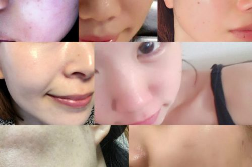 【どんなボロボロ肌もちゅるちゅるたまご肌！？】デートに間に合う♡不思議な液体を塗ってみた結果…
