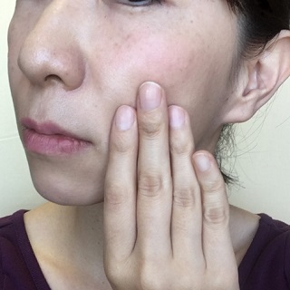 毛穴　黒ずみ　ビフォー