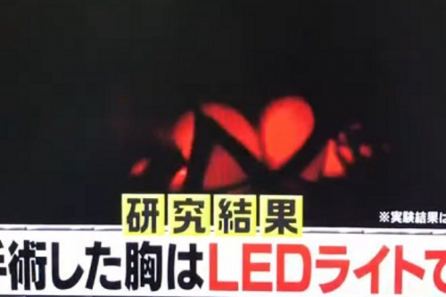 【1ヶ月でB→Dカップ！？】彼氏にも友達にも未来永劫誰にもバレずに爆乳になる方法があった！？最新の豊胸方法を試してみた結果・・・